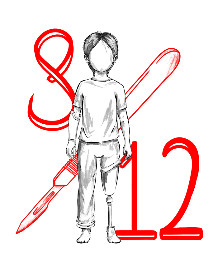 Each limb often requires 8-12 more surgeries as the child grows.